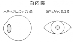 5 乳児の場合 気をつけたい重大な病気 赤ちゃんの目の病気 目についての健康情報 公益社団法人 日本眼科医会