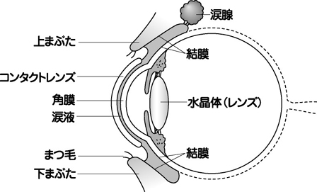 2 コンタクトレンズの全盛時代 コンタクトレンズと感染症 目についての健康情報 公益社団法人 日本眼科医会